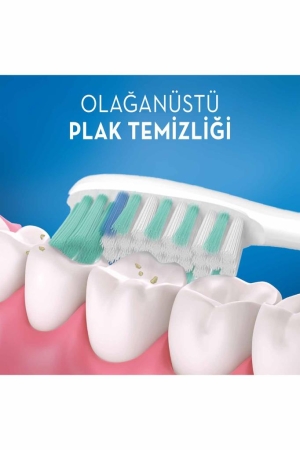 Oral-B UltraThin Precision Gum Care Black Diş Fırçası