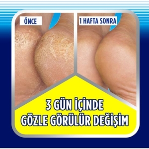 Scholl Topuk Çatlak Kremi 60 gr - 3